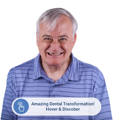 Before photo of a senior patient prior to restorative dental treatment at Paradise Dentistry Cabo.