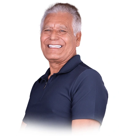 male candidate 3 on 6 dental implants