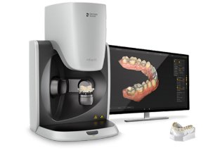 A digital dental scanning machine next to a monitor displaying a 3D model of a patient's teeth, used for treatment planning at Paradise Dentistry Cabo.