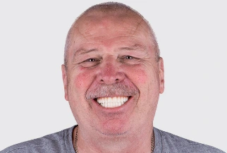 Smiling patient showing the successful results of full-mouth dental restoration at Paradise Dentistry Cabo.