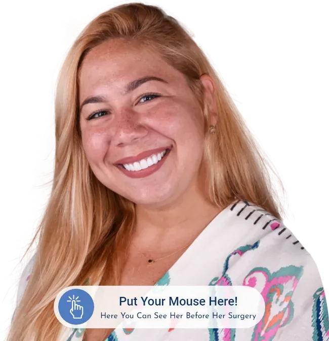 paradise dental cabos before after