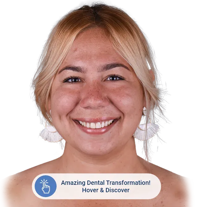 paradise dental cabos before after