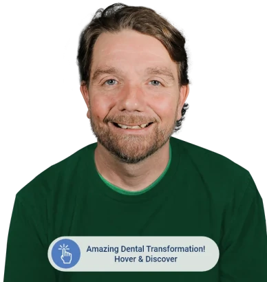 Before photo of a senior patient prior to restorative dental treatment at Paradise Dentistry Cabo.