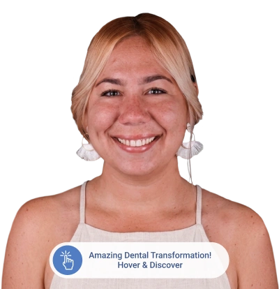 paradise dental cabos before after
