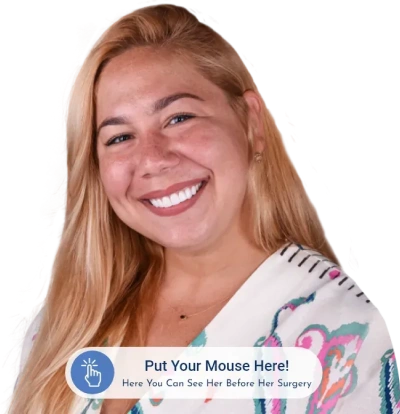 paradise dental cabos before after
